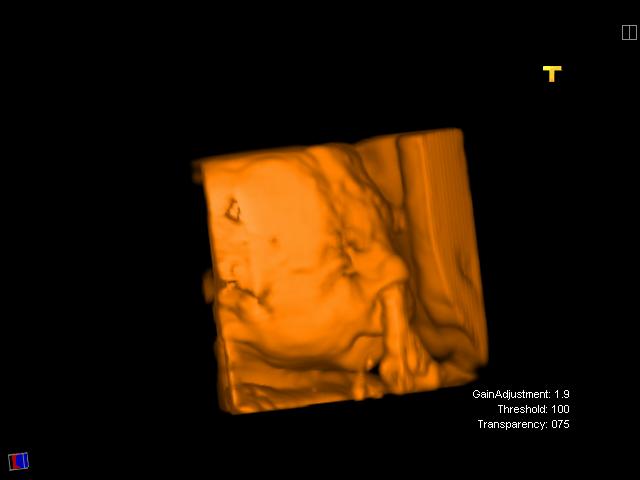2) 4D 21.4.2008  prstík v nosíku.JPG